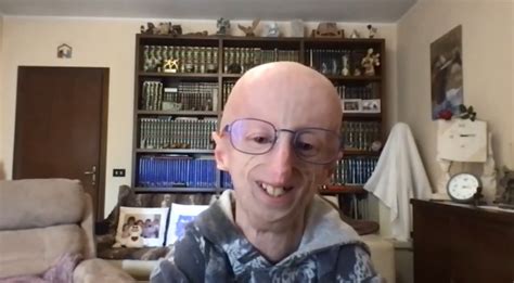 Sammy Basso dejó un legado inspirador en la lucha contra la progeria, demostrando que la vida, aunque breve, es un regalo invaluable.